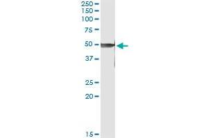 Immunoprecipitation of PRKX transfected lysate using anti-PRKX monoclonal antibody and Protein A Magnetic Bead , and immunoblotted with PRKX MaxPab rabbit polyclonal antibody.
