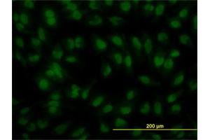 Immunofluorescence of monoclonal antibody to IRF2 on HeLa cell.