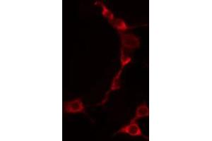 ABIN6274255 staining HuvEc by IF/ICC. (TNFSF9 anticorps  (Internal Region))