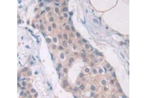 anti-Cancer/testis Antigen 1B (CTAG1B) (AA 1-180) antibody