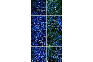 Immunocytochemistry/Immunofluorescence analysis using Rabbit Anti-Tau Monoclonal Antibody, Clone AH36 (ABIN6932902). (tau anticorps  (pSer202, pThr205) (FITC))
