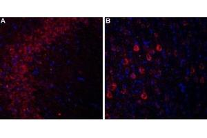 Expression of CaVα2δ3 in rat hippocampus and cortexImmunohistochemical staining of rat hippocampal CA3 region (A) and rat neocortex (B) using Anti-CACNA2D3 (CaVα2δ3) (extracellular) Antibody (ABIN7581838).