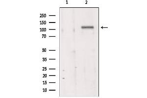 Western blot analysis of extracts from 293, using MKS3 antibody. (TMEM67 anticorps  (Internal Region))