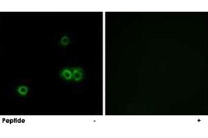 Immunofluorescence analysis of A-549 cells, using MARCH5 polyclonal antibody .