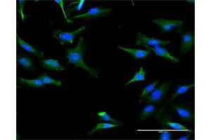 Immunofluorescence of purified MaxPab antibody to TRIT1 on HeLa cell. (TRIT1 anticorps  (AA 1-467))