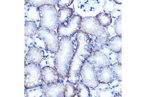 Immunohistochemistry of paraffin-embedded mouse kidney using EXTL3 Rabbit pAb (ABIN1679782, ABIN3018195, ABIN3018196 and ABIN6220395) at dilution of 1:100 (40x lens). (EXTL3 anticorps  (AA 52-220))