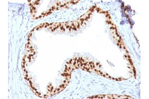 Formalin-fixed, paraffin-embedded human Prostate stained with FOXA1 Mouse Monoclonal Antibody (FOXA1/1512). (FOXA1 anticorps  (AA 372-472))