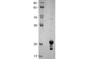 Non-Metastatic Cells 1, Protein (NM23A) Expressed in (NME1) (Transcript Variant 2) protein (His tag)