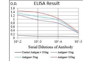 Black line: Control Antigen (100 ng), Purple line: Antigen(10 ng), Blue line: Antigen (50 ng), Red line: Antigen (100 ng), (SOX10 anticorps  (AA 147-252))