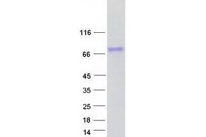 Validation with Western Blot