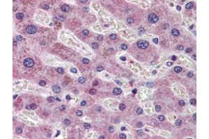 Human Liver: Formalin-Fixed, Paraffin-Embedded (FFPE)