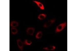 Immunofluorescent analysis of TGase5 staining in U2OS cells. (Transglutaminase 5 anticorps)