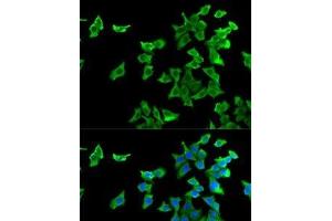 Immunofluorescence analysis of U2OS cells using HTR2B Polyclonal Antibody (Serotonin Receptor 2B anticorps)