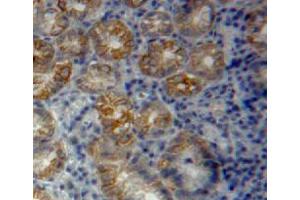 Used in DAB staining on fromalin fixed paraffin-embedded stomach tissue (Vinculin anticorps  (AA 1020-1134))