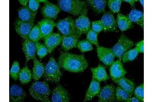 anti-Chaperonin Containing TCP1, Subunit 3 (Gamma) (CCT3) (AA 497-536), (C-Term) antibody