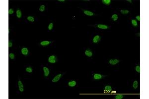 Immunofluorescence of monoclonal antibody to LDB2 on HeLa cell. (LIM Domain Binding 2 Protein anticorps  (AA 1-373))