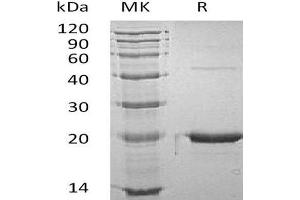 Western Blotting (WB) image for Growth Hormone 1 (GH1) protein (ABIN7320542) (Growth Hormone 1 Protein (GH1))