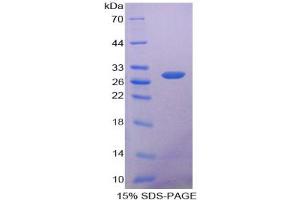 SDS-PAGE analysis of Human ANP32A Protein. (PHAP1 Protéine)