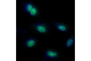 ICC/IF analysis of FUBP1 in HeLa cells line, stained with DAPI (Blue) for nucleus staining and monoclonal anti-human FUBP1 antibody (1:100) with goat anti-mouse IgG-Alexa fluor 488 conjugate (Green). (FUBP1 anticorps)