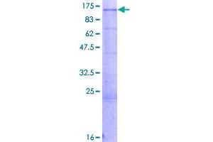 Image no. 1 for Trophinin Associated Protein (TROAP) (AA 1-778) protein (GST tag) (ABIN1323806)