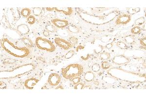 Detection of CR1 in Human Kidney Tissue using Polyclonal Antibody to Complement Receptor 1, Erythrocyte (CR1) (CD35 anticorps  (AA 1780-2039))