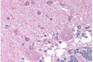 Human Brain, Cerebellum (formalin-fixed, paraffin-embedded) stained with CHRNB2 antibody ABIN214742 at 10 ug/ml followed by biotinylated goat anti-rabbit IgG secondary antibody ABIN481713, alkaline phosphatase-streptavidin and chromogen.