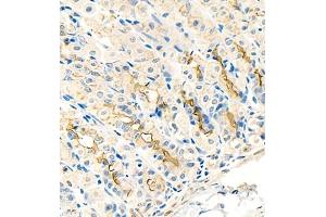 Immunohistochemistry of paraffin embedded mouse stomach using CK13 (ABIN7074412) at dilution of 1:1500 (400x lens)