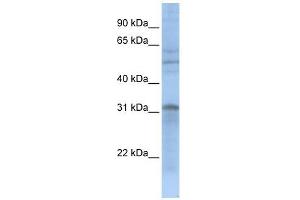 MTCH2 antibody used at 1 ug/ml to detect target protein. (MTCH2 anticorps)