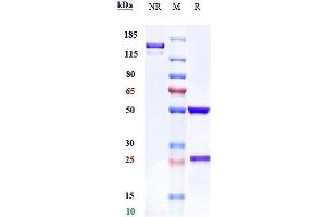 Anti-ROR1 Reference Antibody (zilovertamab) on SDS-PAGE under reducing (R) condition. (Recombinant ROR1 (Zilovertamab Biosimilar) anticorps)