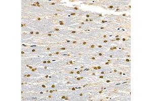 Immunohistochemistry of paraffin embedded rat brain using Transketolase (ABIN7075978) at dilution of 1: 2200 (400x lens)