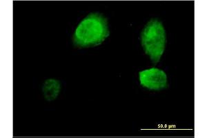Immunofluorescence of monoclonal antibody to ING3 on HeLa cell. (ING3 anticorps  (AA 1-92))