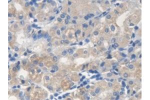 Detection of ME2 in Human Stomach Tissue using Polyclonal Antibody to Malic Enzyme 2, NADP+ Dependent, Mitochondrial (ME2) (Malic Enzyme 2, NADP+ Dependent, Mitochondrial (AA 220-426) anticorps)