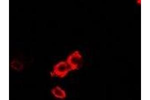 Immunofluorescent analysis of OGT staining in U2OS cells.