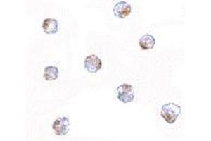 Immunocytochemistry of Aak1 in A-20 cells with AP30003PU-N Aak1 antibody at 5 μg/ml.