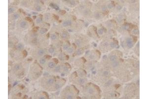 anti-Peroxiredoxin 2 (PRDX2) (AA 6-164) antibody