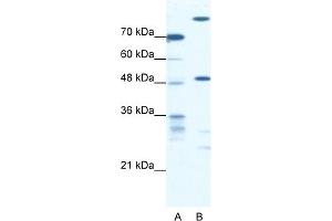WB Suggested Anti-NFS1 Antibody Titration:  0. (NFS1 anticorps  (Middle Region))