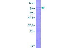 Image no. 1 for F-Box and Leucine-Rich Repeat Protein 6 (FBXL6) (AA 1-539) protein (GST tag) (ABIN1353758)