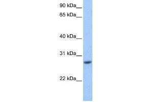 WB Suggested Anti-GSTM3 Antibody Titration: 0. (GSTM3 anticorps  (Middle Region))