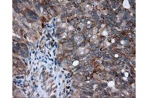 Immunohistochemical staining of paraffin-embedded Kidney tissue using anti-AKR1A1 mouse monoclonal antibody. (AKR1A1 anticorps)
