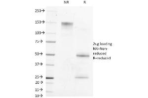 SDS-PAGE Analysis Purified AFP Mouse Monoclonal Antibody (MBS-12). (alpha Fetoprotein anticorps)