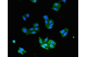 Immunofluorescent analysis of HepG2 cells using ABIN7174316 at dilution of 1:100 and Alexa Fluor 488-congugated AffiniPure Goat Anti-Rabbit IgG(H+L)