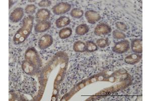 Immunoperoxidase of monoclonal antibody to TYK2 on formalin-fixed paraffin-embedded human small Intestine.