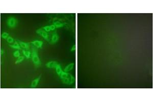 Immunofluorescence analysis of A549 cells, using Stefin B antibody (ABIN5976509).