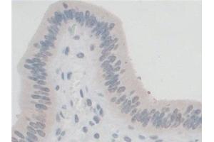 Detection of GFM1 in Mouse Uterus Tissue using Polyclonal Antibody to G-Elongation Factor, Mitochondrial 1 (GFM1)