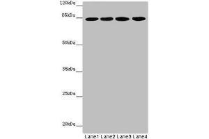 Western blot All lanes: LRSAM1 antibody at 2. (LRSAM1 anticorps  (AA 1-290))