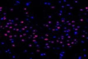 Immunofluorescent analysis of paraformaldehyde-fixed rat striatum using,TCOF1 (ABIN7076003) at dilution of 1: 1400 (TCOF1 anticorps)