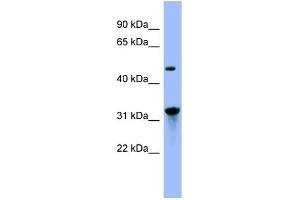 WB Suggested Anti-NIT1  Antibody Titration: 0. (Nitrilase 1 anticorps  (N-Term))