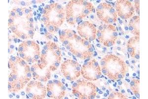 Detection of CYP21A2 in Mouse Kidney Tissue using Polyclonal Antibody to Cytochrome P450 Family 21 Subfamily A Member 2 (CYP21A2)