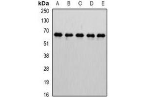 Western blot analysis of MTGR1 expression in Jurkat (A), HepG2 (B), mouse testis (C), mouse kidney (D), rat brain (E) whole cell lysates. (CBFA2T2 anticorps)