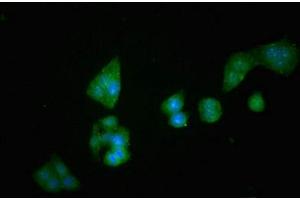 Immunofluorescent analysis of PC-3 cells using ABIN7149984 at dilution of 1:100 and Alexa Fluor 488-congugated AffiniPure Goat Anti-Rabbit IgG(H+L)